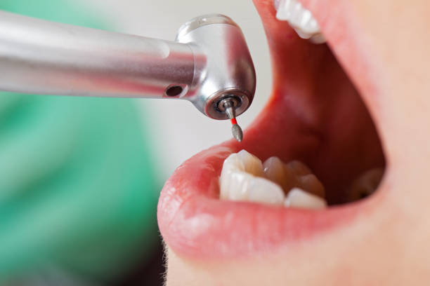 Best Emergency Gum Treatment in Crosby, TX